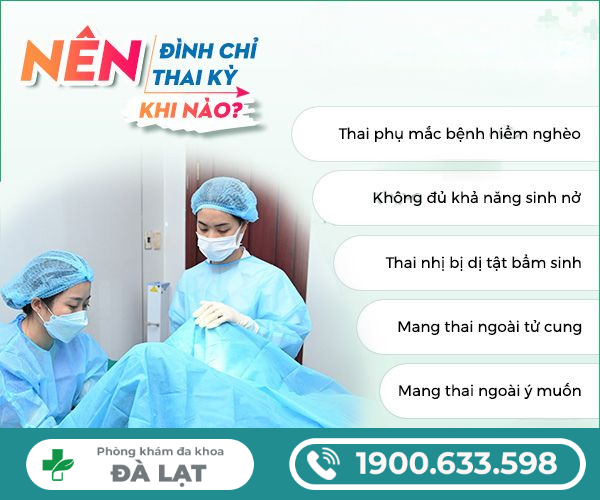 Hình ảnh minh họa